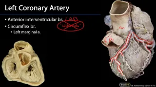 Heart - Coronary Arteries