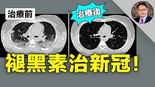 褪黑素改善新冠病毒症狀？還能有助睡眠、抗炎、抗氧化、調節血壓和血管功能？