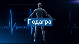 Подагра. Діагностика і лікування. Надашкевич О.Н.