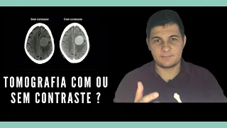 Tomografia com ou sem contraste, qual a diferença ? | Radiologia Prática