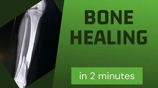 Bone healing in 2 mins!