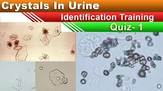 Crystals In Urine Identification Training Quiz ( Part 1/5 )