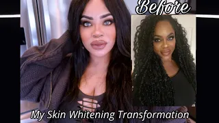 My Extreme Skin Whitening Transformation 2024!