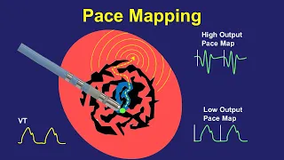 Pace Mapping:  Principles and Pitfalls