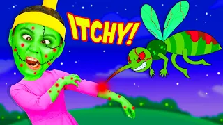 Zombie Itchy Itchy Song | Babanana Kids Songs