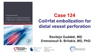 Case 124: PCI Manual - Combined coil and fat embolization for distal vessel perforation