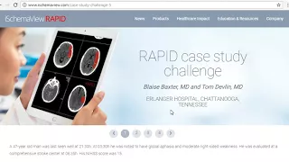 CT perfusion using RAPID software for Stroke