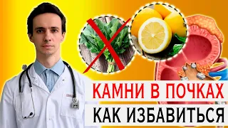 Самый частый вид камней почек: как избавиться 🚑 ОКСАЛАТЫ в моче 🔶 2022