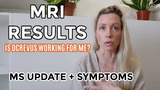 MRI RESULTS - IS OCREVUS WORKING?  / NEW SYMPTOMS / LIVING WITH RELAPSING MULTIPLE SCLEROSIS