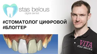 #Стоматолог Стас Белоус делаю #Виниры по цене #мерседес использую #cerec