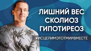 Сколиоз 3 степени // Лишний вес // Гипотиреоз - Онлайн консультация Артема Толоконина