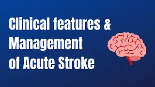 Clinical Features and Management of Acute stroke