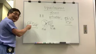 Spontanous venous pulsation in papilledema