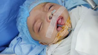 Baby waking after surgery - Anesthesia