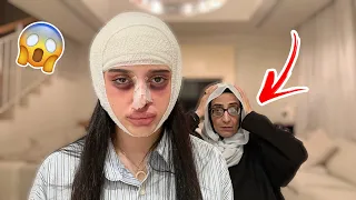 مقلب عملية التجميل بأمي | عصبت وضربتني!!