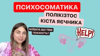 ПСИХОСОМАТИКА: ПОЛІКІСТОЗ, КІСТА ЯЄЧНИКА