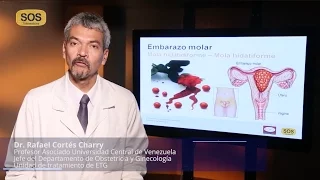 Embarazo Molar - Dr. Rafael Cortés Charry