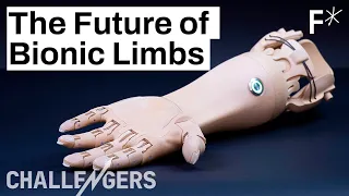 3D printed, mind-controlled prosthetics are here | Challengers by Freethink