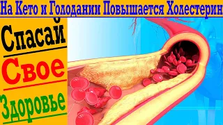 Холестерин повышается на Кето Диете! Как уберечь себя от инфарктов, инсультов и атеросклероза!