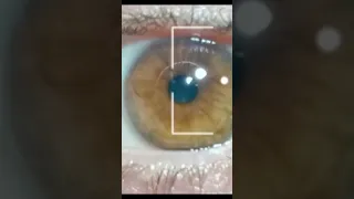 The Six Million Dollar Man Bionic Eye