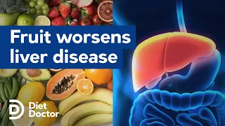 Fruit worsens liver disease