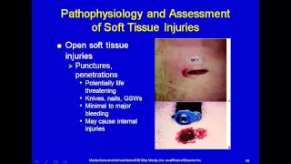 Soft Tissue injuries for the paramedic