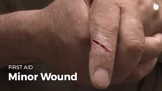 Learn first aid gestures: Minor Wound