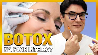 BOTOX na face inteira? | BOTOX Full Face