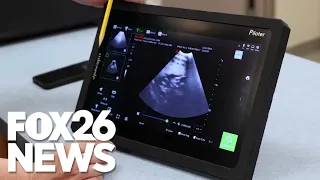 Zoo in California released an elephant ultrasound