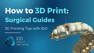 Step-by-Step Guide: How to 3D Print Dental Implant Surgical Guides | iDD