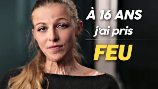 Brûlée au 3e degré, Julie Bourges (Douze Février) nous raconte l'accident qui a changé sa vie