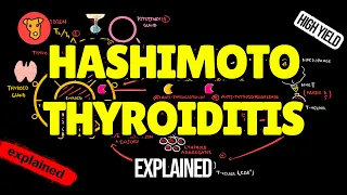 HASHIMOTO THYROIDITIS Pathogenesis Clinical Symptoms Treatment