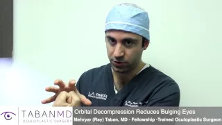 Orbital Decompression Surgery For Thyroid Eye Disease | (877) 697–5173