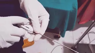 Technique of Trucut biopsy needle handling.