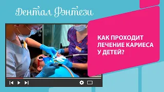 👉Как проходит лечение кариеса в Дентал Фэнтези?