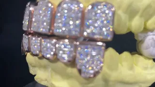 Vvs1 Moissanite Invisible Set Grillz ! 💎🧊