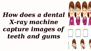 How does a dental X-ray machine capture images of teeth and gums?