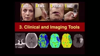Neuro Imaging:  Adult Stroke – Christopher Hess, MD, PhD