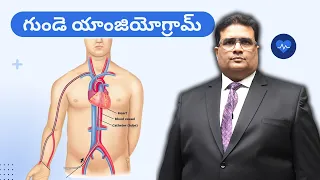 Angiogram | గుండె యాంజియోగ్రామ్ | What you need to know in Telugu