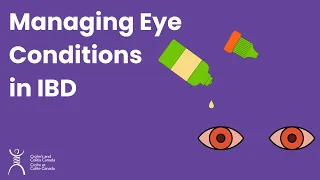 Managing Eye Conditions in IBD