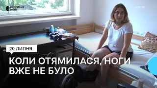 Втратила ногу через російські обстріли. Історія 34-річної Оксани Гринь
