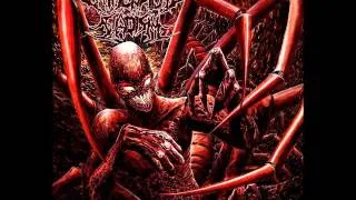 Pathological Sadism - Human Centipede