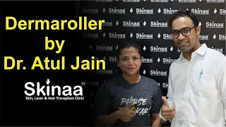 Dermaroller Treatment by Dr .Atul Jain | Skinaa Clinic