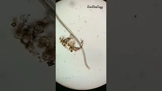 Nematode under Microscope 🔬#biology #music #zoology #viral #trending #relaxing