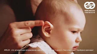 Детские ушные корректоры для исправления лопоухости Арилис