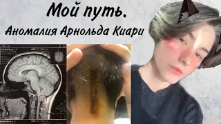 Мой путь. Аномалия Арнольда-Киари.