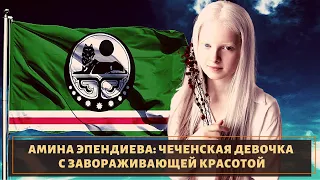 Амина Эпендиева - чеченская девочка альбинос с завораживающей красотой