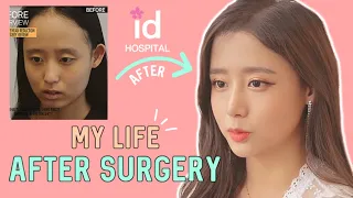 Forehead Reduction l Hairline Lowering Surgery Review at ID Hospital Korea