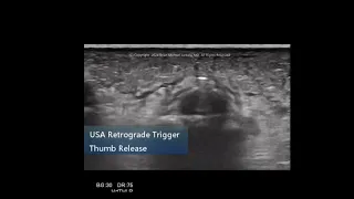 USA Retrograde TriggerThRelease - Insert, Verify, Position, Release, Check