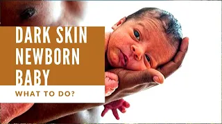 Help - my newborn baby skin color has become dark? Why? What to do?